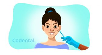 Harmonização orofacial (HOF): tudo que você precisa saber!