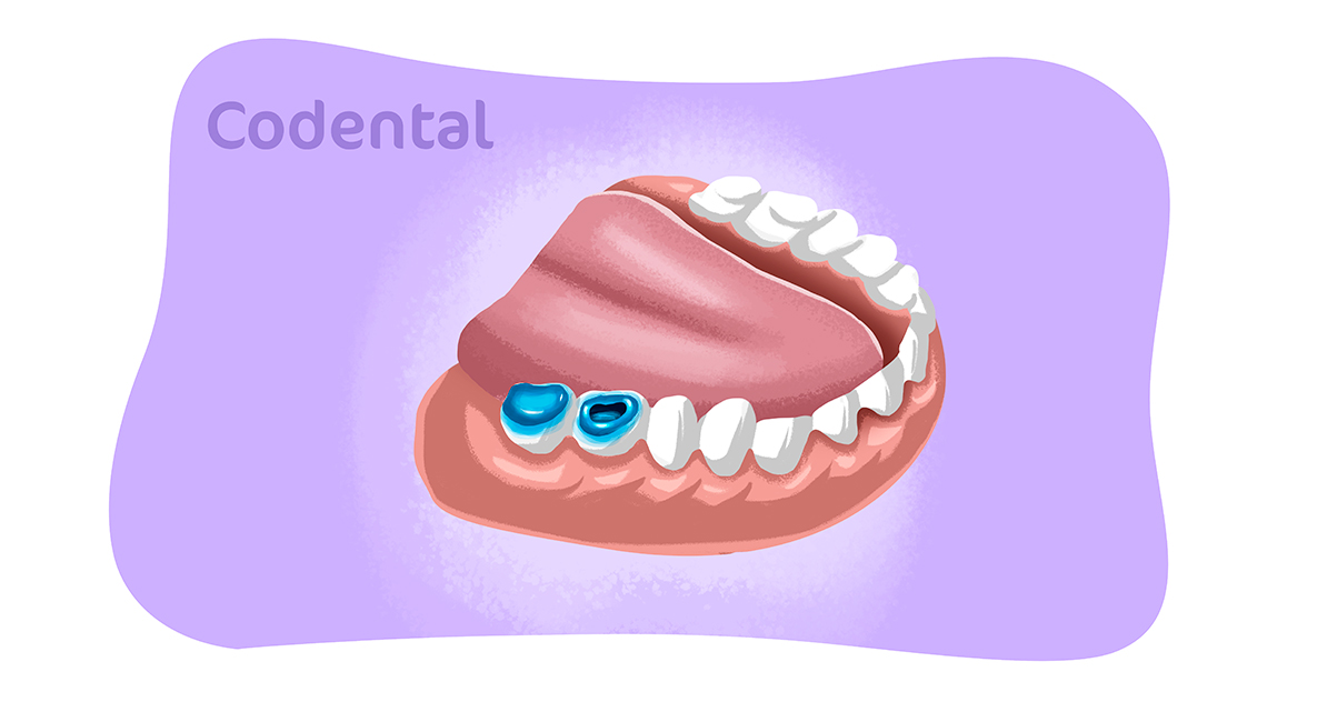 condicionamento acido em dentina