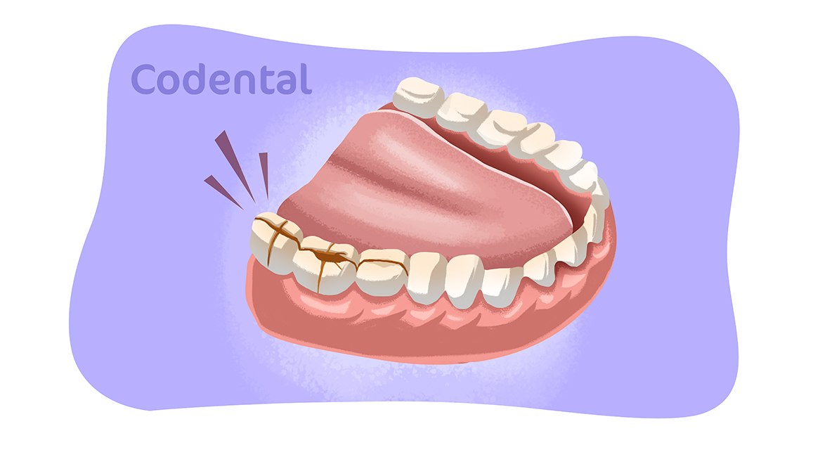 síndrome do dente rachado