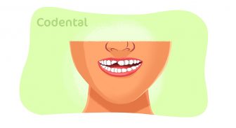 Traumatismo dental: tudo que você precisa saber
