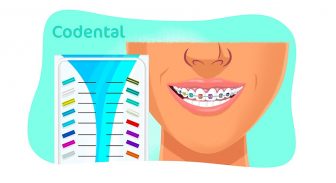 Cores de aparelho que não desbota: dicas e muito mais!