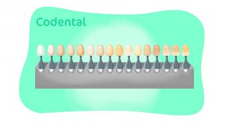 Cores de resina para dentes: tudo que você precisa saber