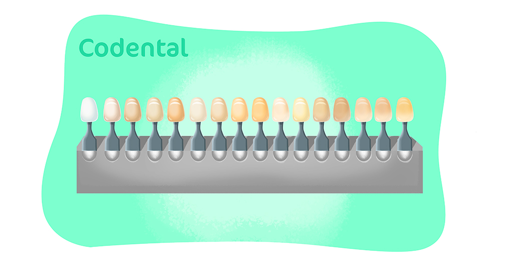 Cores de resina para dentes