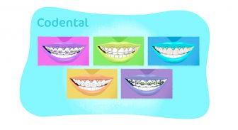 Tipos de aparelhos dentais: conheça todos