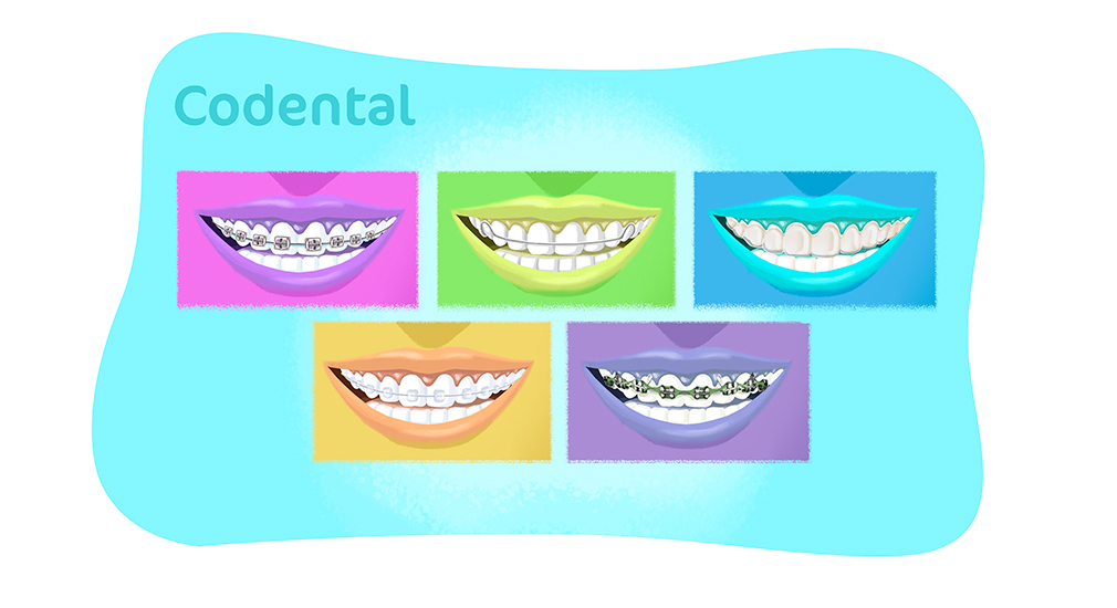 tipos de aparelho dental