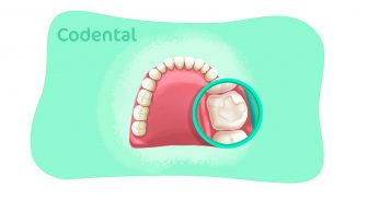 Curativo no dente: para que serve e muito mais