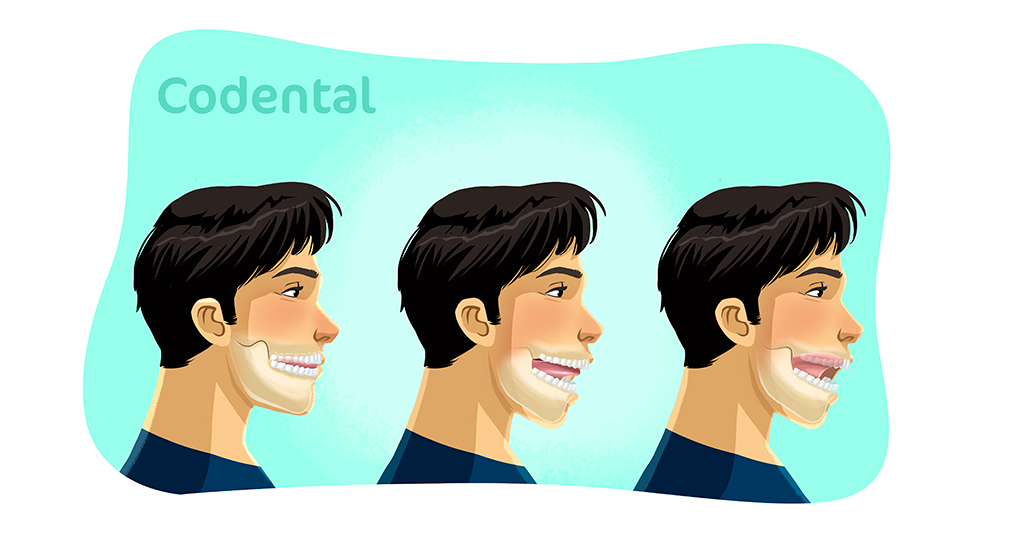 Mewing Tutorial: Resultados e Antes e Depois. Exercícios para o Rosto