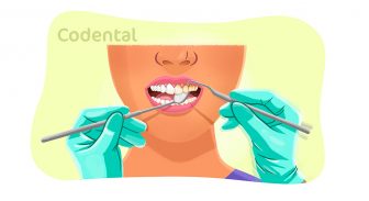Raspagem periodontal: tudo que você precisa saber