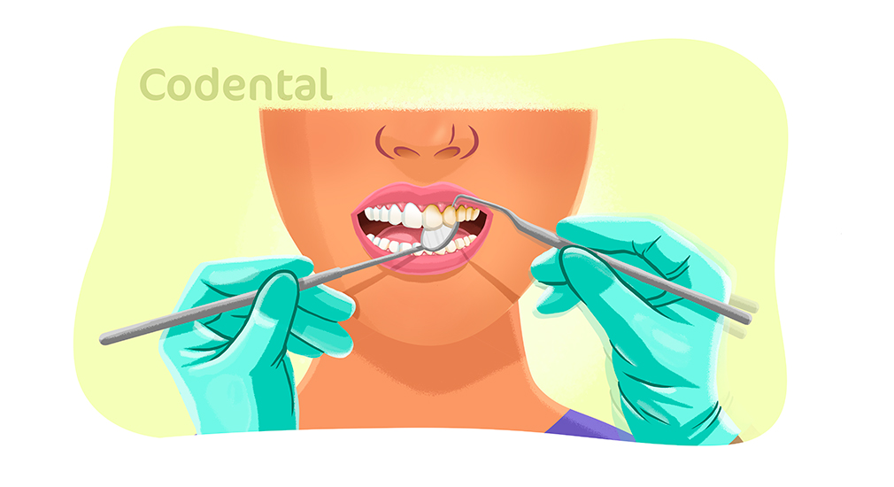 Raspagem periodontal