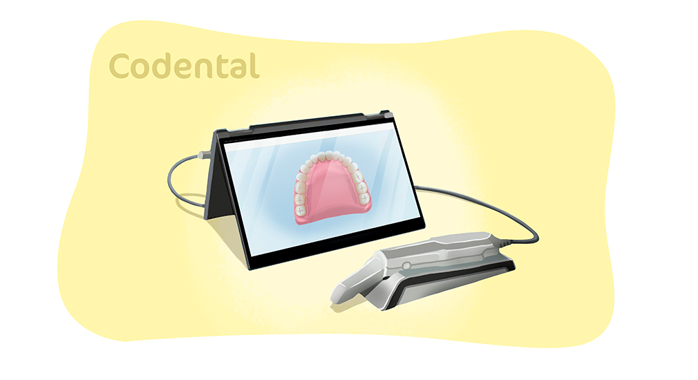 Scanner intraoral