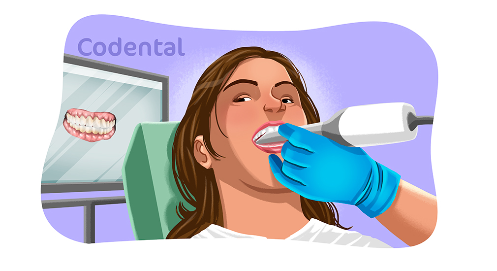 escaneamento intraoral