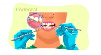 Raspagem supragengival: tudo sobre o procedimento