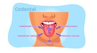 Doenças de língua: como diagnosticar e tratar