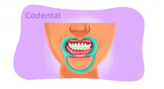 Gengivite: tratamento e muito mais sobre essa doença