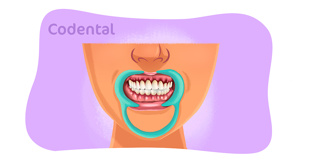 Gengivite tratamento