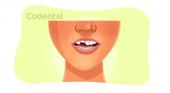 Dente quebrado: tudo que você precisa saber