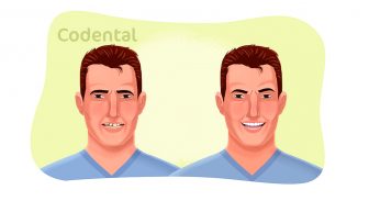 Dentística: tudo que você precisa saber sobre esta especialidade