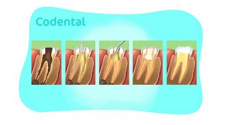 Endodontia: tudo que você precisa saber