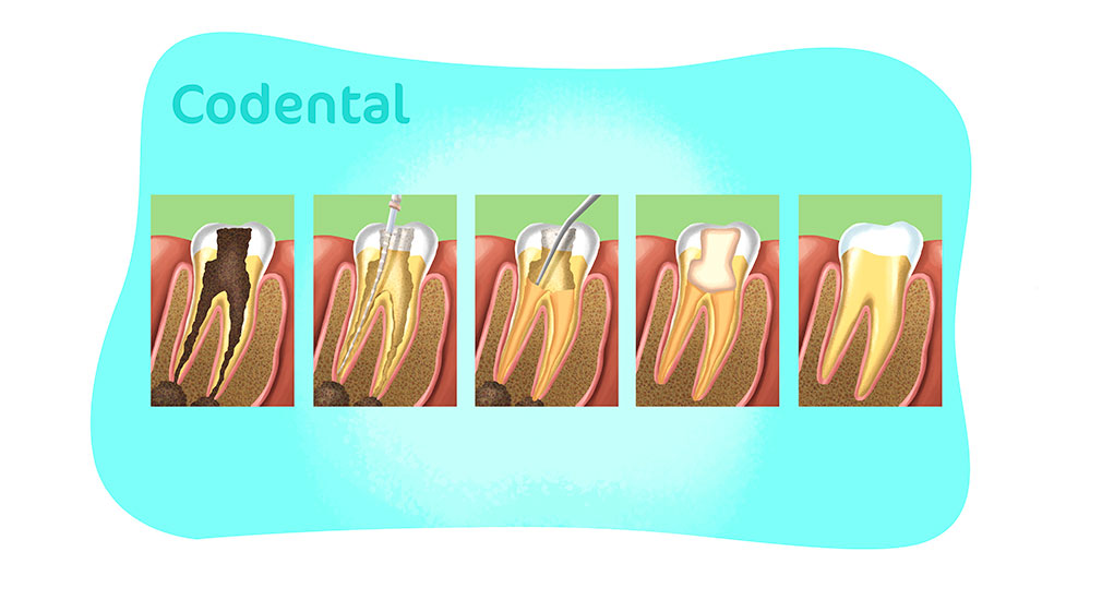 Endodontia