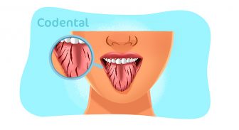 Língua rachada: aprenda tudo sobre esse problema