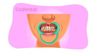 Periodontite: nova classificação e muito mais