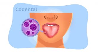 HPV: entenda tudo sobre essa doença