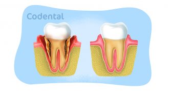 Periodontia: entenda tudo sobre essa especialidade