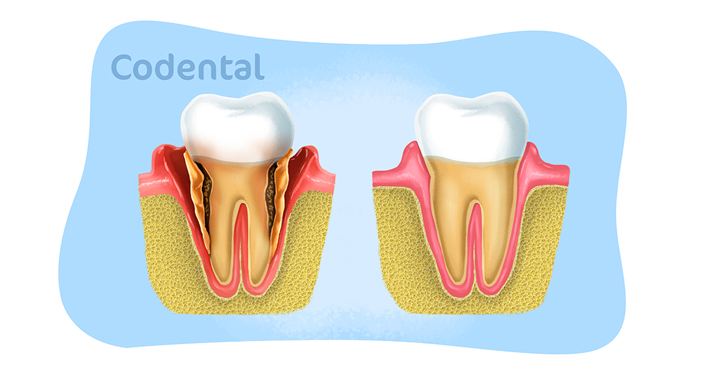 Periodontia