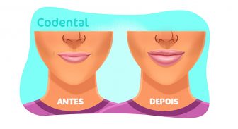 Preenchimento labial: saiba tudo sobre essa tendência