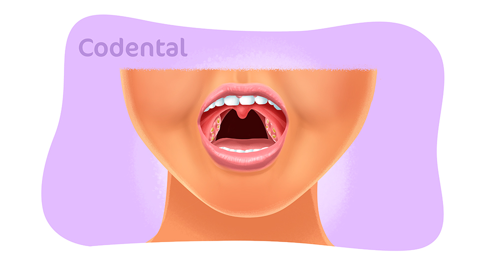 Ronco e dor? 10 sinais de que você precisa de um dentista