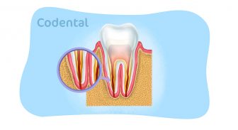 Canal no dente: entenda tudo sobre esse procedimento