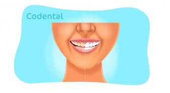 Dentes de porcelana: tudo que você precisa saber