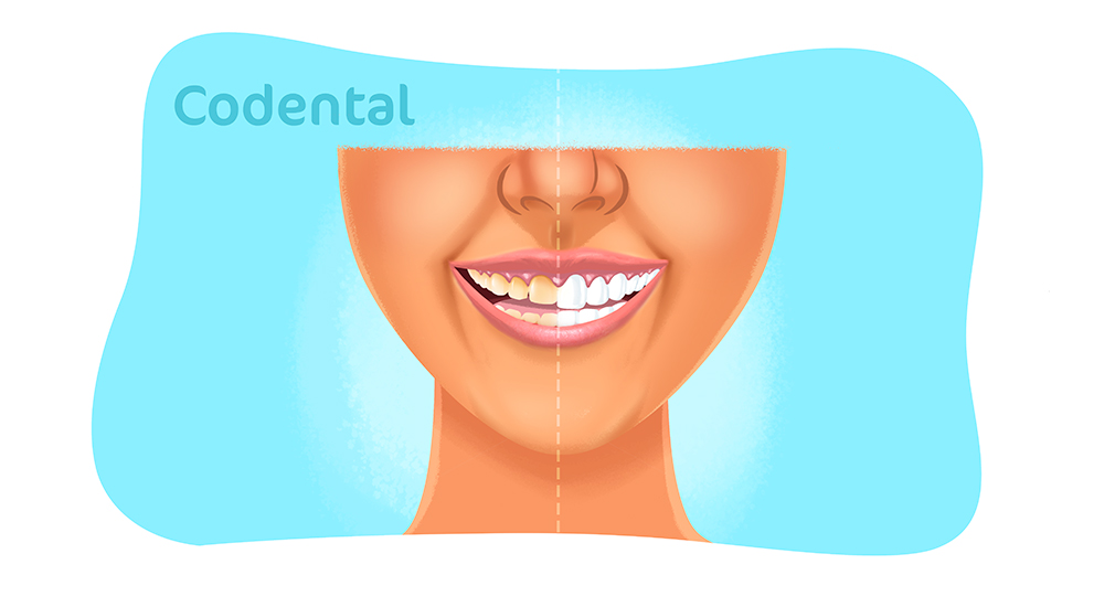 O que fazer quando o paciente não sabe onde está doendo? – Dental