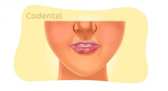 Feridas nos lábios: causas, tratamentos e muito mais