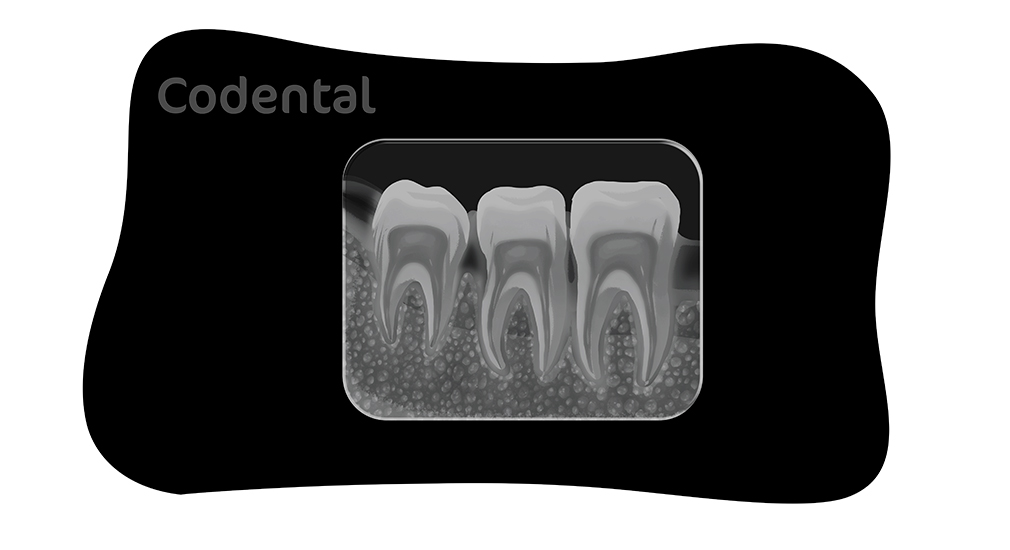 radiografia periapical