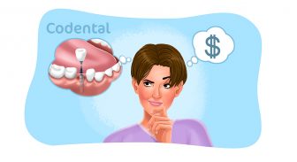 Valor do implante dentário: custos e benefícios desse procedimento