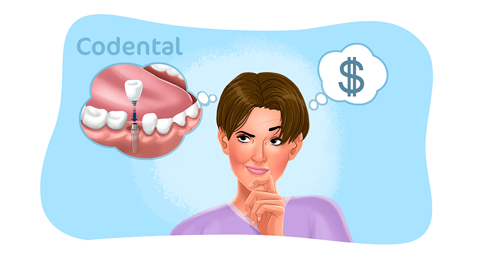 Valor implante dentário