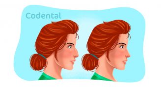 Rinomodelação: saiba tudo sobre esse procedimento