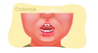 Estomatite em bebê: entenda tudo sobre essa condição