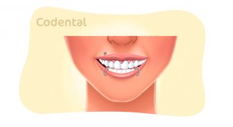 Piercing na boca: saiba como orientar seu paciente