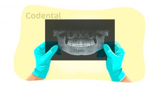 Radiologia na odontologia: cursos, importância e muito mais!