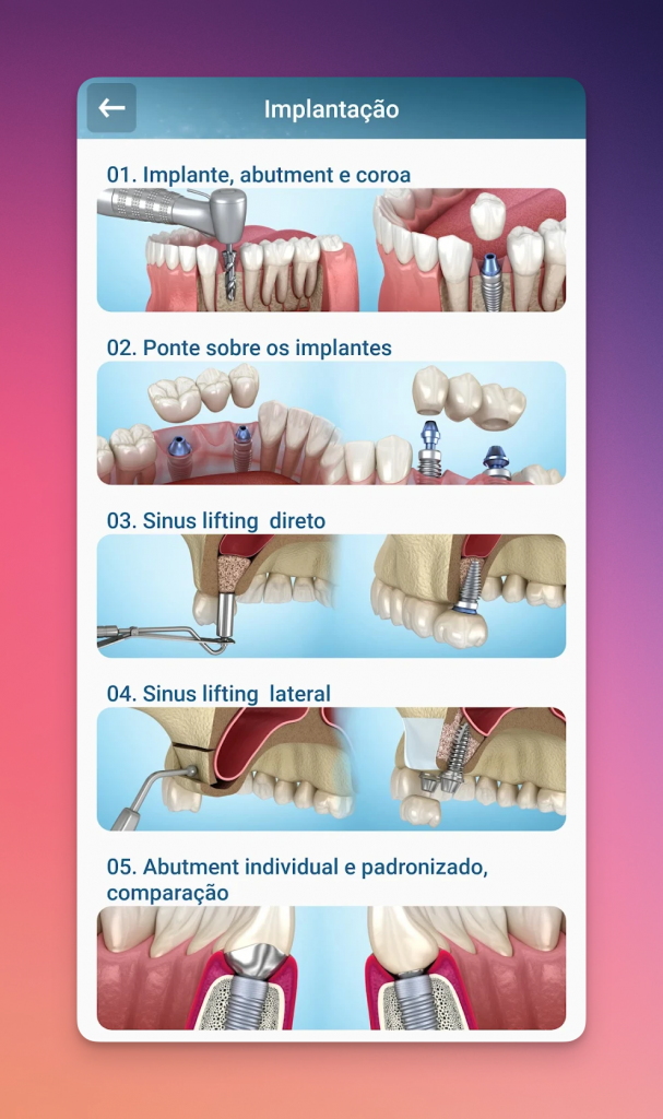 Aplicativo odontológico Ilustrações Dentárias
