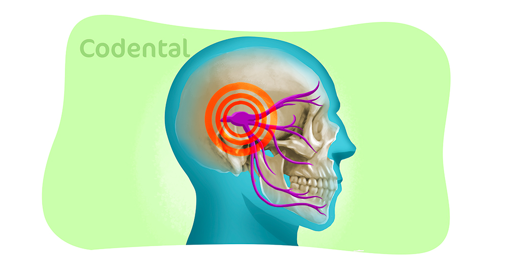 neuralgia do trigemeo