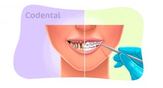 Ortodontia: tudo que você precisa saber sobre essa área!