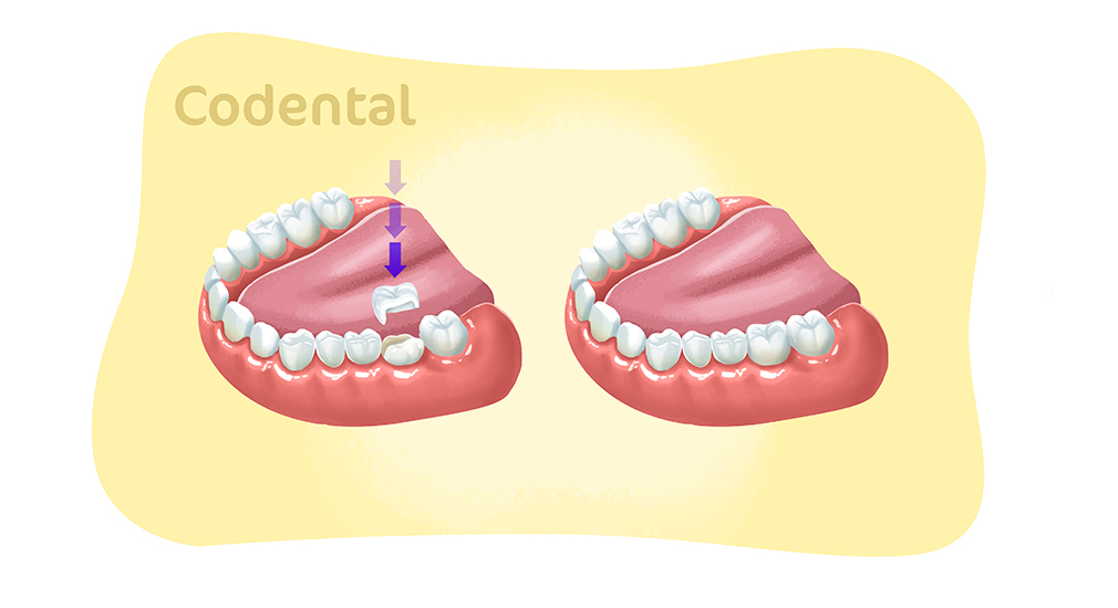 bloco dentário