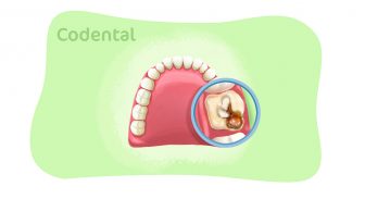 Dente furado: saiba tudo sobre!