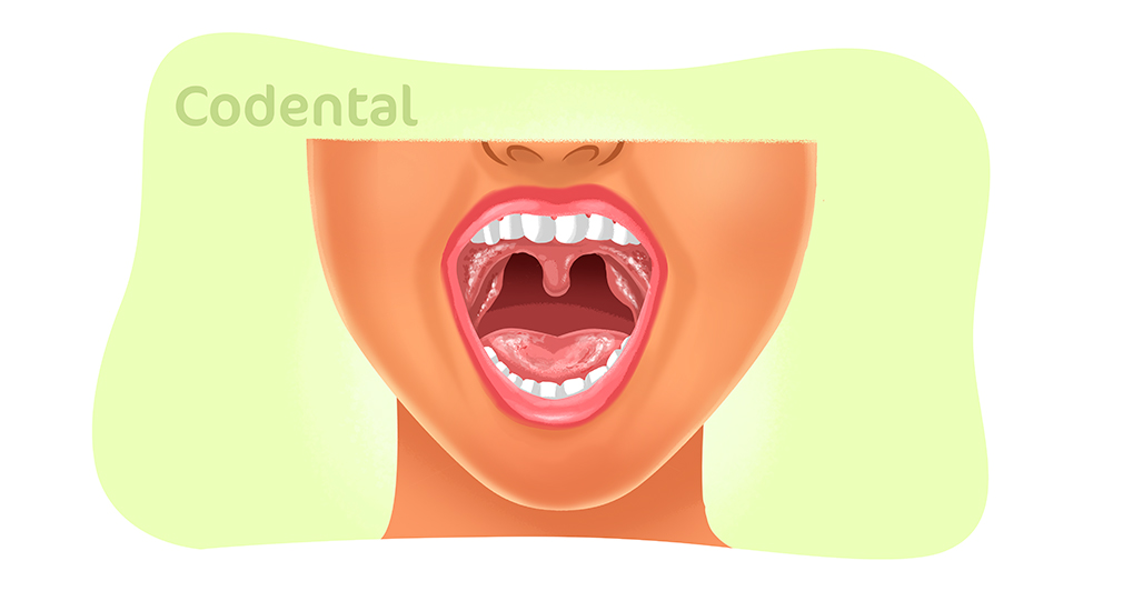 mucosa bucal