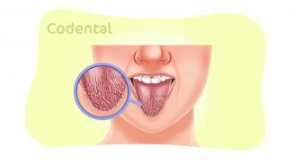 Xerostomia: tudo que você precisa saber!