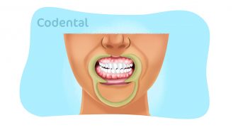 Gengiva branca: 12 causas que você precisa conhecer!