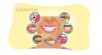 Patologia Bucal: principais tipos e como prevenir e muito mais!